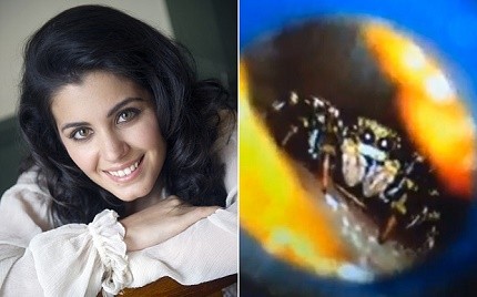 Shocked Katie Melua found spider living in her ear